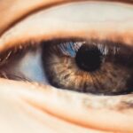 麦粒腫（ものもらい）の適切な治療法を決定するために、眼科医が患部の状態を詳しく診察している様子